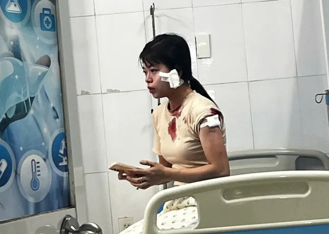 Trần tình của người vợ bị chồng cũ đến tận nơi làm việc đánh phải nhập viện ảnh 2