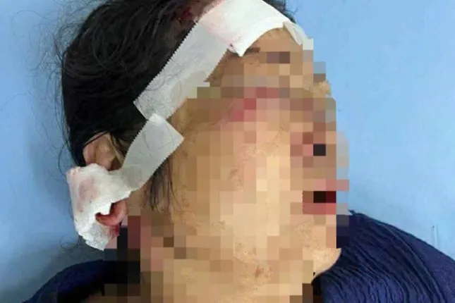 Đôi nam nữ bị nhóm đối tượng phục kích tấn công trong hẻm vắng ảnh 2
