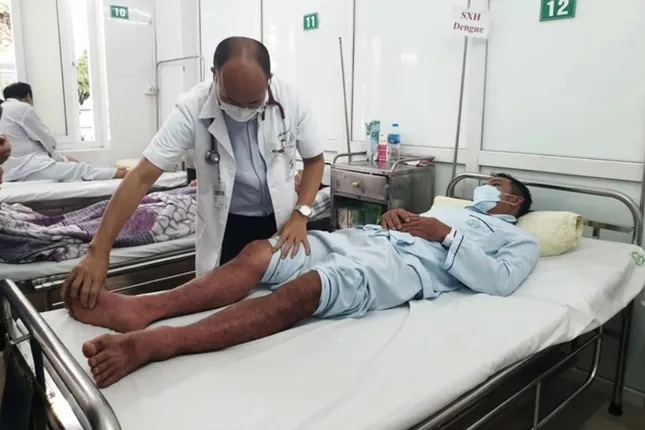 Sốt xuất huyết Dengue: Nguy kịch vì chủ quan ảnh 2