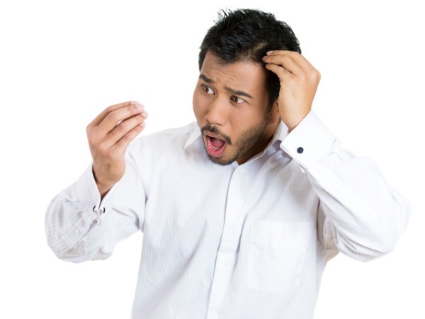 Rụng tóc, hói đầu: do thiếu dinh dưỡng trực tiếp cho tế bào mầm tóc ảnh 2
