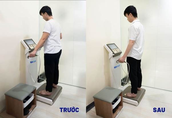 Giảm 22kg, chàng trai 23 tuổi lấy lại cuộc sống khỏe mạnh ảnh 1