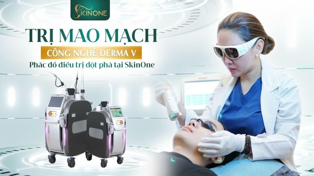 SkinOne - Đột phá trong điều trị mao mạch cánh mũi và da thâm đỏ ảnh 2