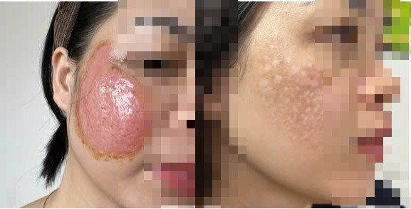 Thẩm mỹ 'chui' – Lợi nhuận xây bằng rủi ro sức khỏe con người ảnh 2