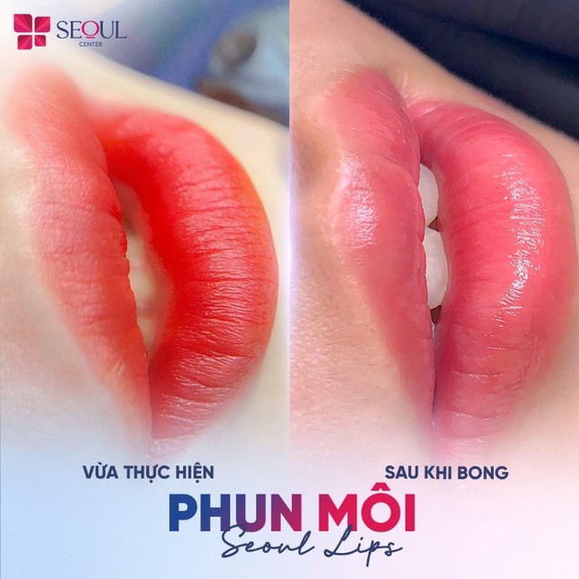 Khám phá địa chỉ phun môi công nghệ cao uy tín ảnh 3