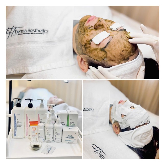 HT Derma Aesthetics – Chăm sóc da chuẩn y khoa cùng dịch vụ khách hàng tận tâm ảnh 2