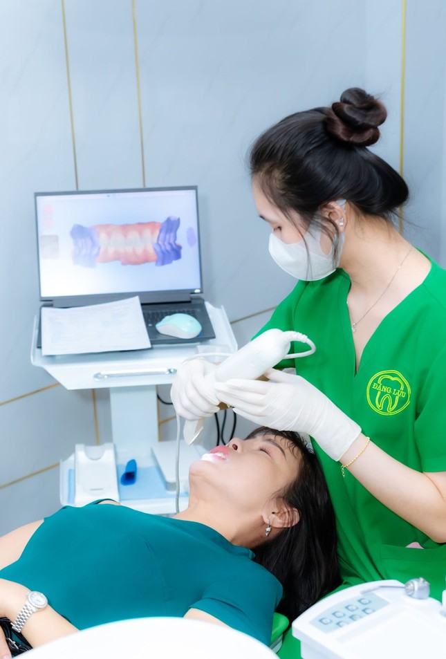 Bảng giá niềng răng chỉnh nha tại Nha Khoa Đăng Lưu ảnh 3