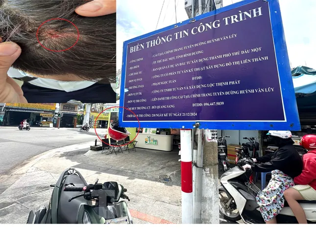 Nhiều người đi đường bị chảy máu đầu vì bảng thông tin công trình trên vỉa hè ảnh 3