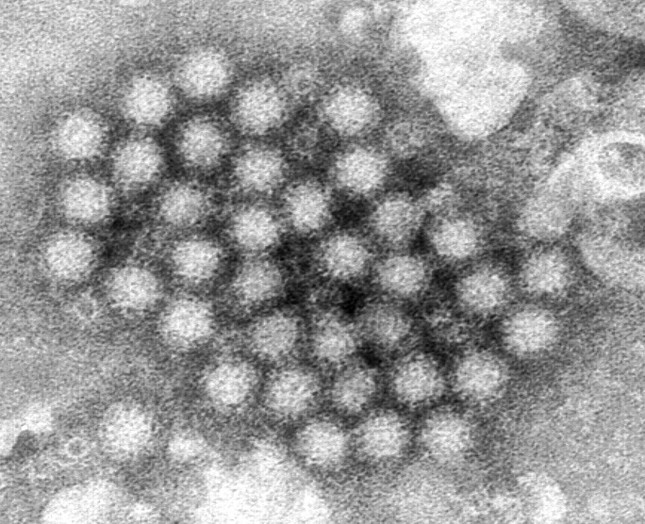 Sự thật về loại virus gây bệnh cực kỳ dễ lây lan trên tàu du lịch ảnh 3