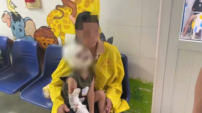 Sử dụng xăng để đốt diệt kiến, hai anh em bỏng nặng ảnh 1