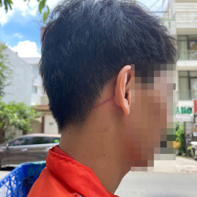 Điều tra vụ nam shipper ở TPHCM bị đánh gãy sống mũi ảnh 2