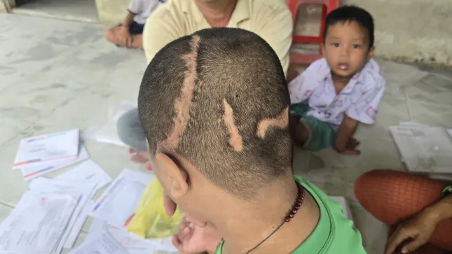 Hơn 70 triệu đồng ủng hộ gia đình bé trai 11 tuổi 7 lần mổ sọ vì TNGT ảnh 2