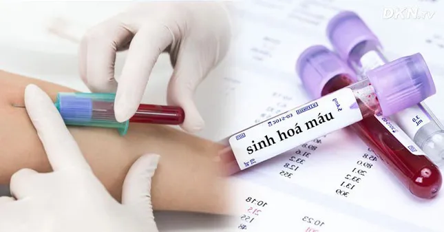 Những lưu ý đặc biệt trước khi xét nghiệm máu để có kết quả chuẩn xác nhất ảnh 3