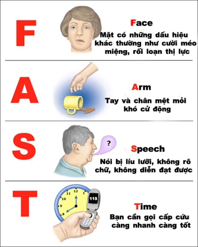 3 việc tuyệt đối không được làm với người bị đột quỵ kẻo &apos;ân hận mấy cũng muộn&apos; ảnh 1