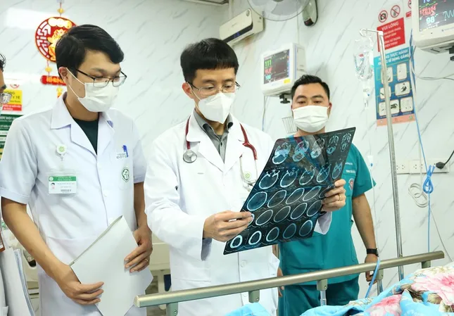 25% người bị đột quỵ não tái phát, bác sĩ chỉ cách ngăn ngừa để... &apos;giữ mạng&apos; ảnh 3