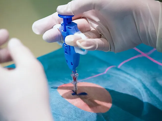 Những quan niệm sai lầm &apos;khủng khiếp&apos; về ung thư, có thể rút ngắn cuộc sống của bạn ảnh 1