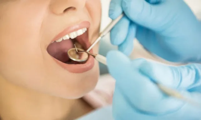 Răng khôn &apos;mọc dại&apos;: Khi nào thì bắt buộc phải nhổ? ảnh 4