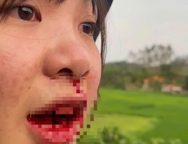 Liên tiếp xảy ra các vụ người ngồi trên ô tô hành hung phụ nữ đi xe máy trên đường ảnh 3