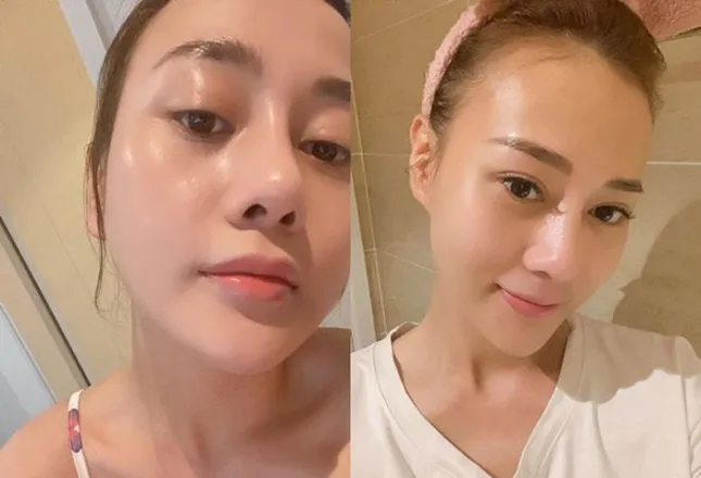 Tự tin khoe mặt mộc nhưng mới đây Phương Oanh lại bị soi ra dấu hiệu lão hóa làn da ảnh 4