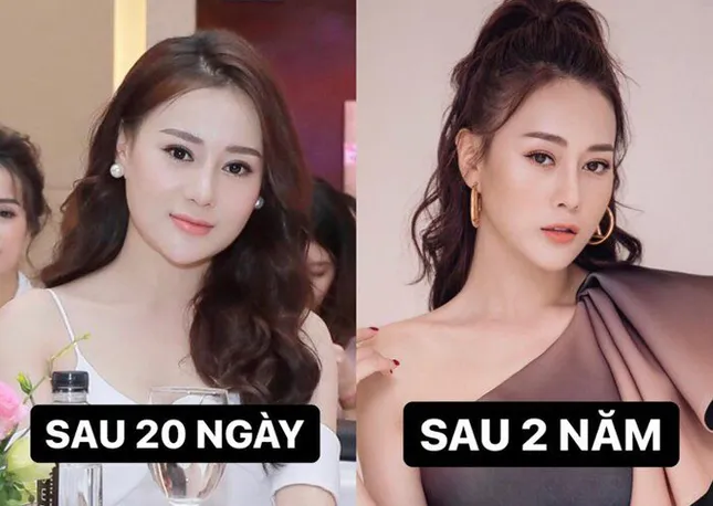 Tự tin khoe mặt mộc nhưng mới đây Phương Oanh lại bị soi ra dấu hiệu lão hóa làn da ảnh 1