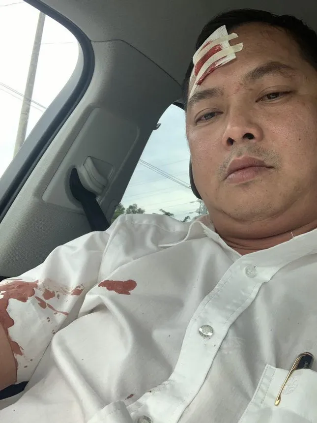 Tin mới vụ đại ca giang hồ huy động hàng chục đàn em vây xe chở công an ảnh 2