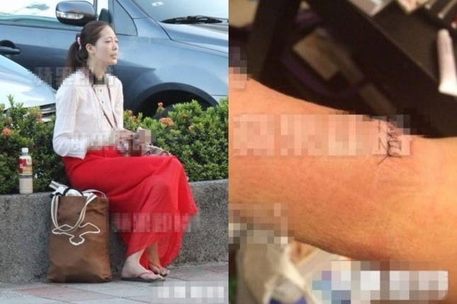 Ngoài Lam Khiết Anh, nhiều mỹ nhân châu Á bị lạm dụng đến tự sát ảnh 6