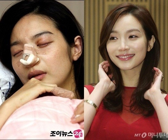 Những sao nữ châu Á từng bị chồng bạo hành dã man trong nhiều năm ảnh 3