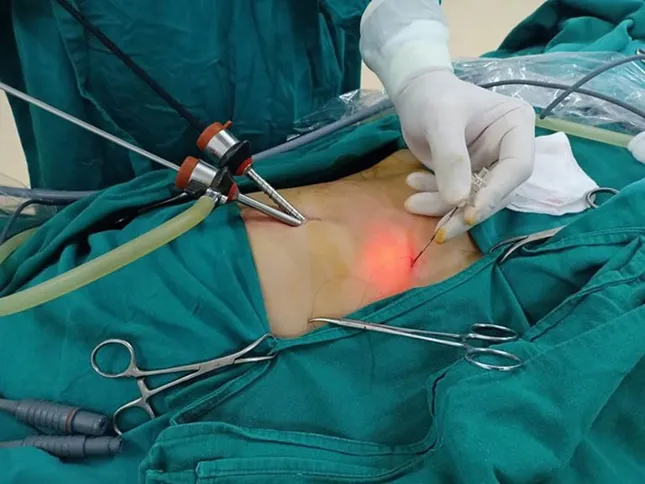 &apos;Thủ phạm giấu mặt&apos; của ung thư đường mật ảnh 1