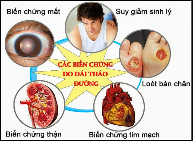 Biến chứng kép tim mạch – võng mạc ở bệnh nhân tiểu đường: Có thể ngăn chặn từ sớm ảnh 1