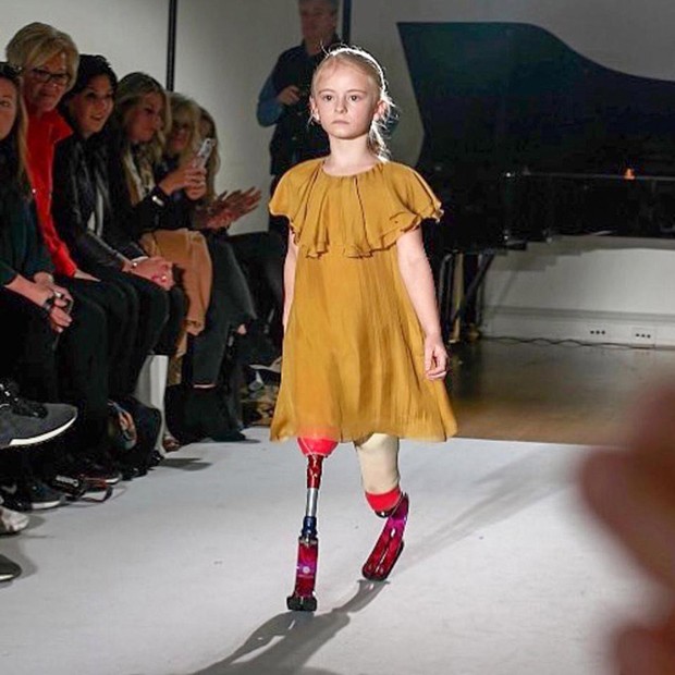Anh: Người mẫu nhí đặc biệt tự tin sải bước trên sàn catwalk ảnh 2