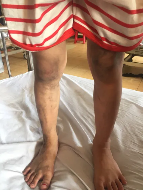 Quảng Bình: 3 đứa trẻ bị cha ruột nhốt trong nhà rồi phóng hỏa ảnh 2