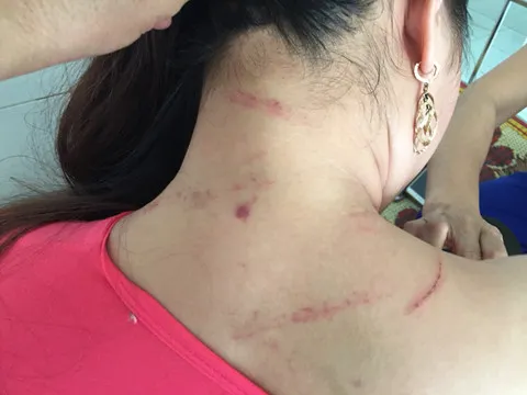 Quảng Bình: 3 đứa trẻ bị cha ruột nhốt trong nhà rồi phóng hỏa ảnh 3