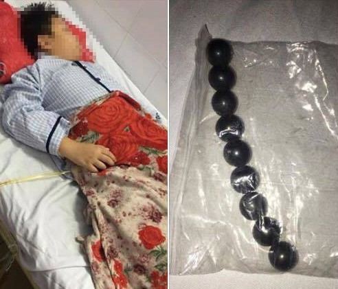 Sẽ làm rõ vụ việc nam sinh lớp 5 bị bạn học ép nuốt 9 viên bi sắt ảnh 1