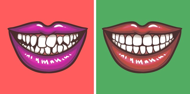 6 lỗi siêu kinh điển khiến bạn đã "ế" còn kém hấp dẫn hơn ngàn lần ảnh 4