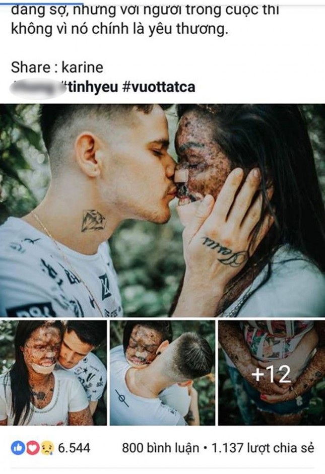 Tình yêu như mơ: Chàng trai dịu dàng ôm cô gái có hình hài xấu xí ảnh 1