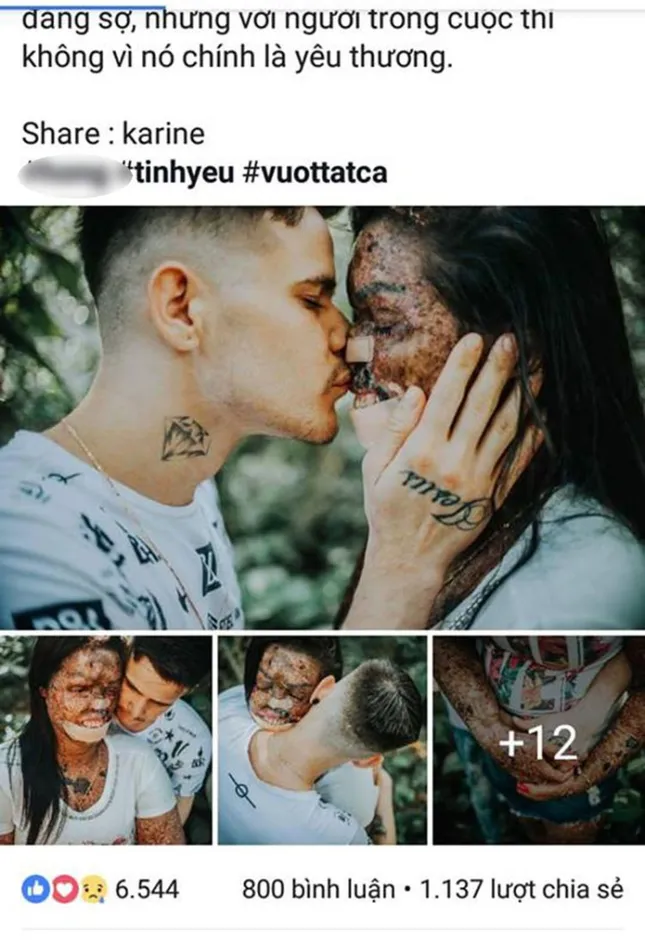Tình yêu như mơ: Chàng trai dịu dàng ôm cô gái có hình hài xấu xí ảnh 1