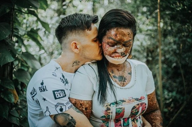 Tình yêu như mơ: Chàng trai dịu dàng ôm cô gái có hình hài xấu xí ảnh 4