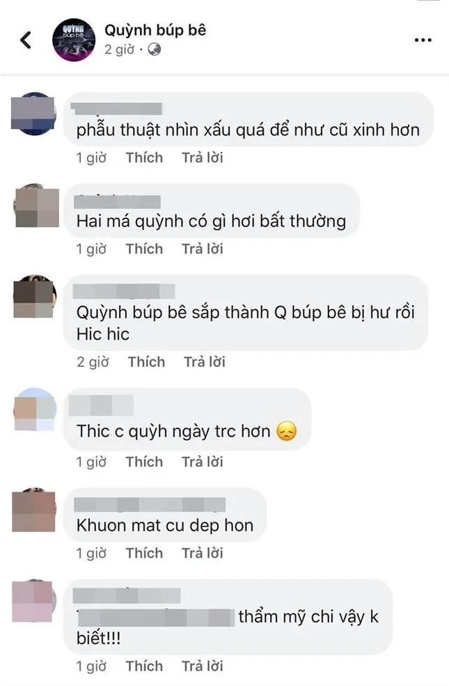 Nữ chính "Quỳnh Búp Bê" gây sốc với gương mặt “dao kéo” bị ví như “búp bê hư” ảnh 6