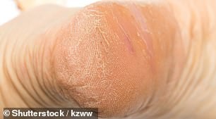 Tiết lộ không ngờ về sức khỏe qua dấu hiệu ở 2 bàn chân ảnh 4