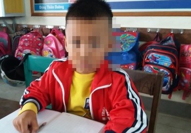 Quảng Bình: Học sinh bị cô giáo tát chấn động sọ não vì làm cả 2 đề kiểm tra ảnh 1