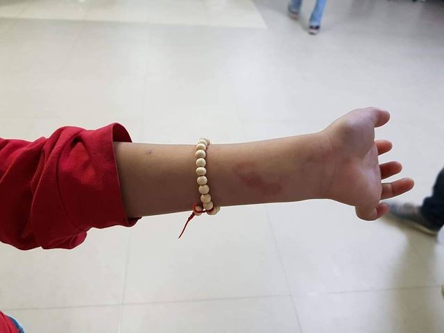 Cô giáo dùng thước vụt học sinh bầm tím vai: Phạt 5 triệu đồng, đình chỉ công tác một tháng ảnh 2