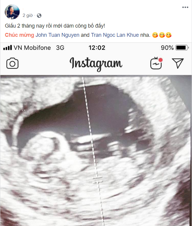 Ông xã của siêu mẫu Lan Khuê xác nhận hai vợ chông sắp chào đón con đầu lòng ảnh 2