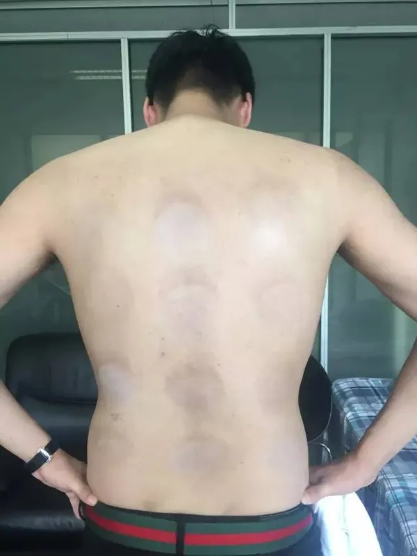 Chàng trai "có tâm nhất quả đất", phơi mình thử 12 loại kem chống nắng để review ảnh 4