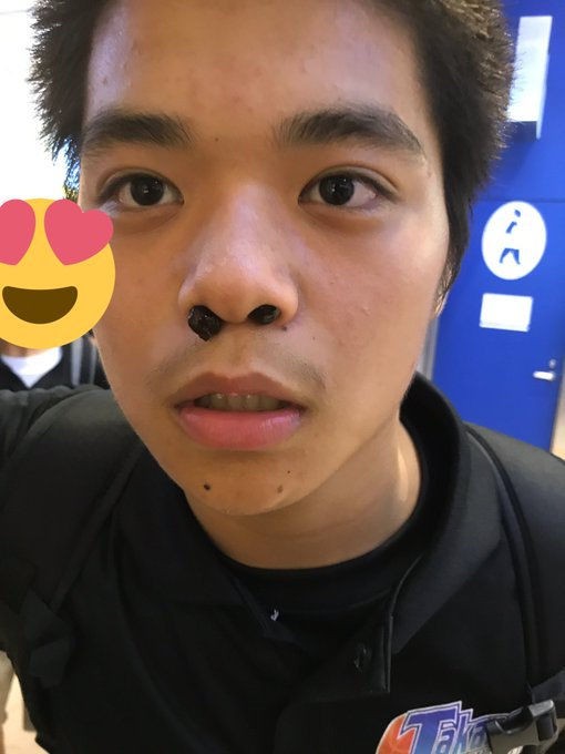 Rộ trào lưu kỳ cục khiến giới trẻ "điên đảo": Nhét trân châu vào mũi để... chụp ảnh ảnh 5