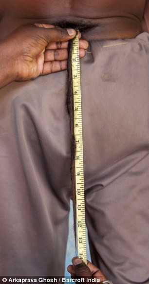 Người đàn ông có 'đuôi' dài 36 cm, leo trèo như khỉ - ảnh 2