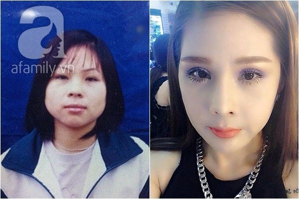 Chia sẻ 'rùng rợn' của cô gái phẫu thuật thẩm mỹ 14 lần trong 10 năm - ảnh 1