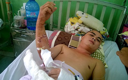 Mâu thuẫn từ tiếng nẹt pô, truy sát cả nhà chủ quán thịt chó - ảnh 1