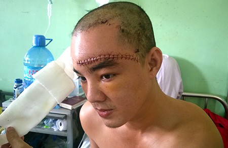 Mâu thuẫn từ tiếng nẹt pô, truy sát cả nhà chủ quán thịt chó - ảnh 2