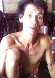 Gã phu trầm chữa bệnh bằng 'xương người' - ảnh 1