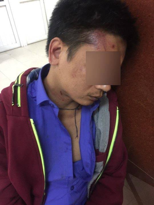 Bảo vệ bệnh viện Phụ sản đánh người nhà bệnh nhân - ảnh 2
