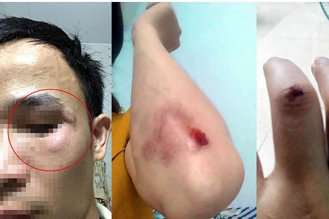 Xác định nam thanh niên vụ xô ngã bà bầu sau va chạm giao thông - ảnh 1